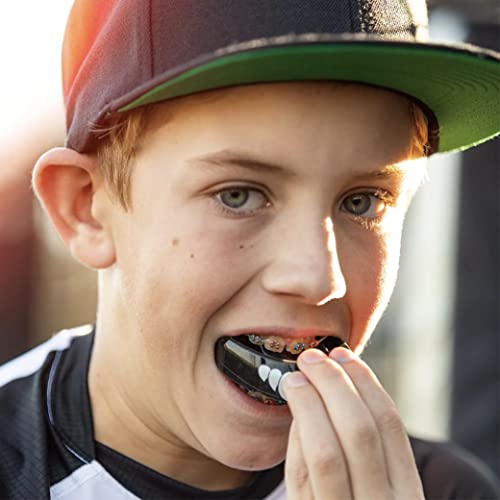 Mouth Guard for Braces, Upper Teeth Protection, Instant Fit R639